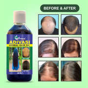 AATMAM AYURVEDA  HAIR GROWTH OIL (FREE CASH ON DELIVERY )