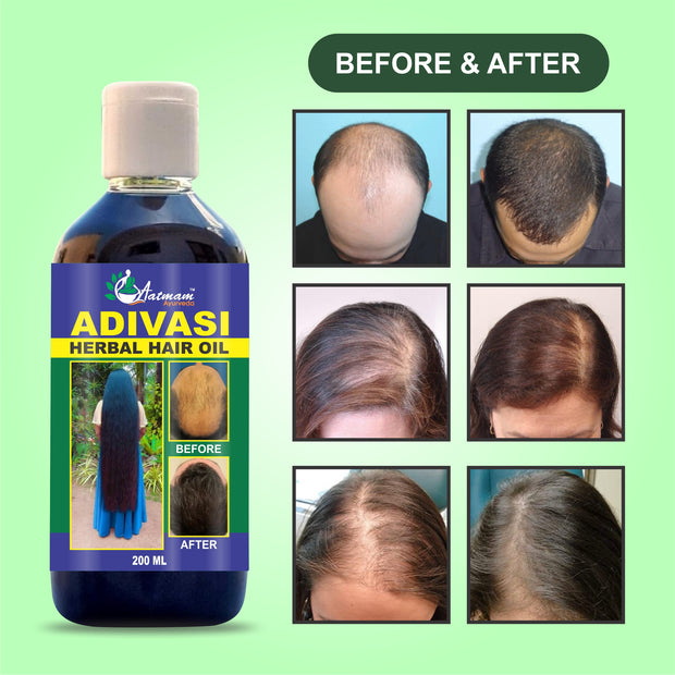 AATMAM AYURVEDA  HAIR GROWTH OIL (FREE CASH ON DELIVERY )
